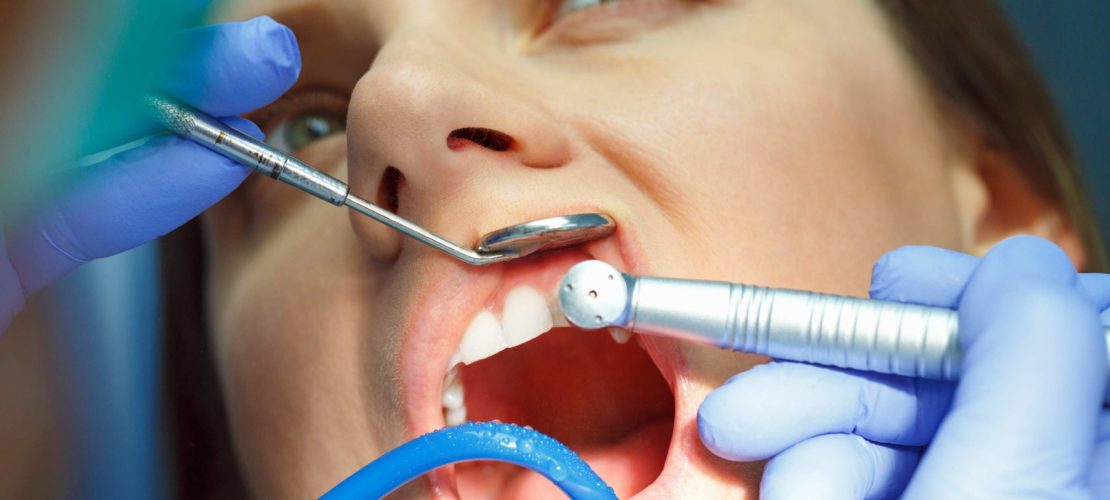 woman-getting-a-dental-treatment-P6M4ZTE